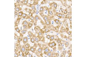 Immunohistochemistry of paraffin-embedded human liver using NDUFB9 Rabbit mAb (ABIN7268815) at dilution of 1:200 (40x lens). (NDUFB9 Antikörper)