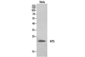 Western Blot (WB) analysis of HeLa, HepG2 cells using Neurotensin Polyclonal Antibody. (Neurotensin Antikörper  (Internal Region))