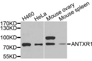 Western blot analysis of extracts of various cells, using ANTXR1 antibody. (ANTXR1 Antikörper)