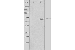 Western blot analysis of extracts from 293 cells, using KCNA5 antibody. (KCNA5 Antikörper  (Internal Region))