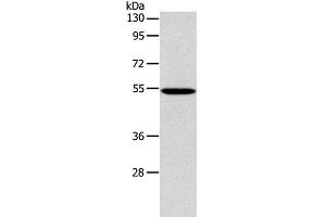 Western Blot analysis of 293T cell using ERG Polyclonal Antibody at dilution of 1:650 (ERG Antikörper)