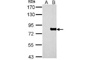 WB Image MX1 antibody detects MX1 protein by Western blot analysis.
