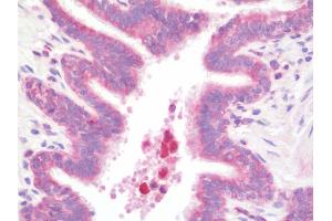 Anti-Delta3 / DLL3 antibody IHC staining of human lung. (DLL3 Antikörper  (AA 519-548))
