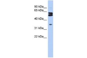 WB Suggested Anti-OGFOD1 Antibody Titration:  0. (OGFOD1 Antikörper  (Middle Region))