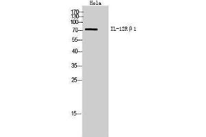 Western Blotting (WB) image for anti-Interleukin 12 Receptor beta 1 (IL12RB1) (Internal Region) antibody (ABIN3178960) (IL12RB1 Antikörper  (Internal Region))