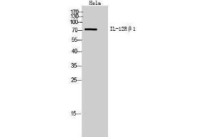 Western Blotting (WB) image for anti-Interleukin 12 Receptor beta 1 (IL12RB1) (Internal Region) antibody (ABIN3181454)