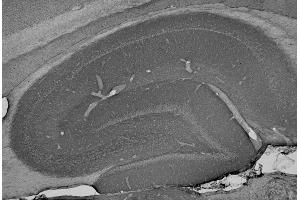 Adult rat hippocampus immunohistochemistry.