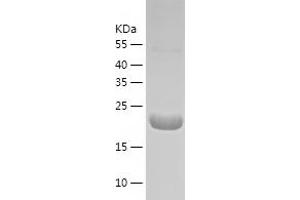 Western Blotting (WB) image for rho GDP Dissociation Inhibitor (GDI) beta (ARHGDIB) (AA 1-201) protein (His tag) (ABIN7124862)