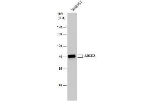 WB Image ABCD2 antibody detects ABCD2 protein by western blot analysis. (Abcd2 Antikörper)