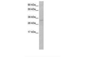 Image no. 1 for anti-Tumor Protein P53 (TP53) (AA 281-330) antibody (ABIN202409) (p53 Antikörper  (AA 281-330))