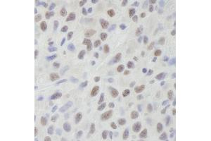 Immunohistochemistry (IHC) image for anti-ATP-Dependent RNA Helicase A (DHX9) (C-Term) antibody (ABIN7448530) (DHX9 Antikörper  (C-Term))