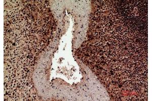 Immunohistochemistry (IHC) analysis of paraffin-embedded Human Spleen, antibody was diluted at 1:100. (HLA-DQ1/DQ2 Antikörper  (Internal Region))