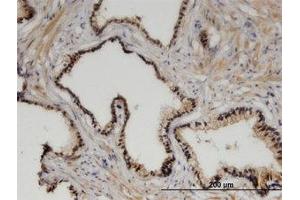 Image no. 1 for anti-Zinc Fingers and Homeoboxes 3 (ZHX3) (AA 863-955) antibody (ABIN599532) (ZHX3 Antikörper  (AA 863-955))