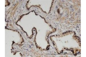 Image no. 1 for anti-Zinc Fingers and Homeoboxes 3 (ZHX3) (AA 863-955) antibody (ABIN599532)