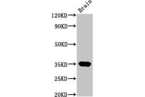 Western Blot Positive WB detected in: Rat brain tissue All lanes: NKX3-2 antibody at 4. (NKX3-2 Antikörper  (AA 1-333))