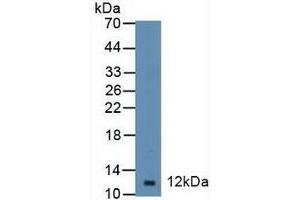 Detection of DBI in Mouse Spleen Tissue using Polyclonal Antibody to Diazepam Binding Inhibitor (DBI) (Diazepam Binding Inhibitor Antikörper  (AA 1-104))