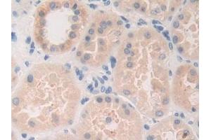 Immunohistochemistry (IHC) image for anti-Farnesyl-Diphosphate Farnesyltransferase 1 (FDFT1) (AA 269-417) antibody (ABIN7433993)