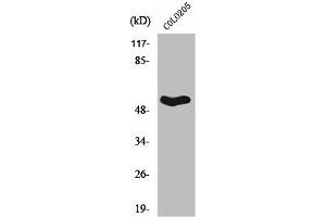Western Blot analysis of COLO205 cells using Septin 1 Polyclonal Antibody (Septin 1 Antikörper  (Internal Region))