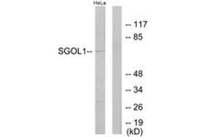 Western Blotting (WB) image for anti-Shugoshin 1 (SGOL1) (AA 271-320) antibody (ABIN2889634) (Shugoshin Antikörper  (AA 271-320))