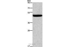 Western blot analysis of Mouse stomach tissue, using CTSE Polyclonal Antibody at dilution of 1:525