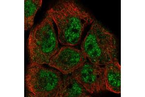 Immunofluorescent staining of A-431 cells using DUSP10 polyclonal antibody  shows positivity in nucleus (green) but excluded from the nucleoli. (DUSP10 Antikörper  (AA 180-291))