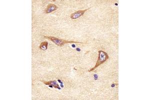 (ABIN652309 and ABIN2841413) staining NPTX1 in human brain tissue sections by Immunohistochemistry (IHC-P - paraformaldehyde-fixed, paraffin-embedded sections).