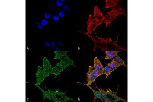 Immunocytochemistry/Immunofluorescence analysis using Rabbit Anti-ULK1 Polyclonal Antibody . (ULK1 Antikörper  (AA 567-577) (FITC))