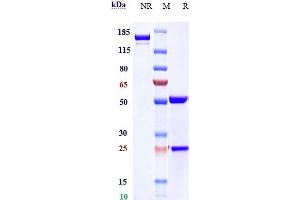 Anti- Human CLDN6( IMAB027) on SDS-PAGE under reducing (R) condition.