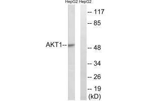 Western blot analysis of extracts from HuvEc cells, treated with Serum (30 % , 30 mins), using Akt (Ab-129) antibody.