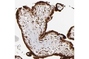 Immunohistochemical staining of human placenta with IGF2BP3 polyclonal antibody  shows strong cytoplasmic and nuclear positivity in trophoblastic cell at 1:50-1:200 dilution. (IGF2BP3 Antikörper)