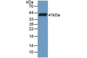 Western Blotting (WB) image for anti-Tryptase alpha/beta 1 (TPSAB1) (AA 161-262) antibody (ABIN7426172)