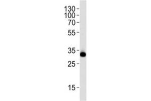 Western Blotting (WB) image for anti-Ribosomal Protein S6 (RPS6) (AA 220-249) antibody (ABIN3032477)