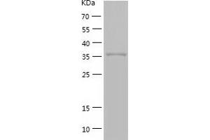 Western Blotting (WB) image for Guanosine Monophosphate Reductase (GMPR) (AA 1-345) protein (His tag) (ABIN7286055) (GMPR Protein (AA 1-345) (His tag))