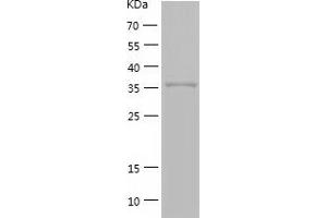 GMPR Protein (AA 1-345) (His tag)