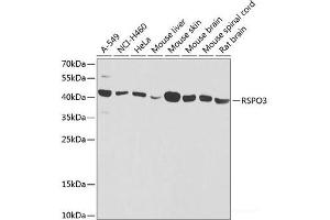 Western blot analysis of extracts of various cell lines using RSPO3 Polyclonal Antibody at dilution of 1:1000. (R-Spondin 3 Antikörper)