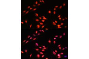Immunofluorescence analysis of Rat colon using CTSC antibody (ABIN7267936) at dilution of 1:100 (40x lens). (ESRRA Antikörper  (AA 1-423))