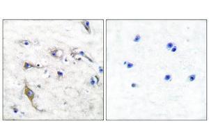 Immunohistochemistry (IHC) image for anti-PRA1 Domain Family, Member 2 (PRAF2) (C-Term) antibody (ABIN1848624) (PRAF2 Antikörper  (C-Term))