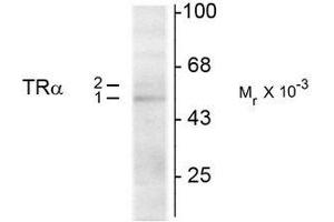 Western Blotting (WB) image for anti-Thyroid Hormone Receptor, alpha (THRA) (N-Term) antibody (ABIN371844) (THRA Antikörper  (N-Term))
