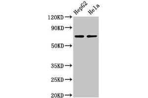 Western Blot Positive WB detected in: HepG2 whole cell lysate, Hela whole cell lysate All lanes: AMFR antibody at 4 μg/mL Secondary Goat polyclonal to rabbit IgG at 1/50000 dilution Predicted band size: 73 kDa Observed band size: 73 kDa (AMFR Antikörper  (AA 485-643))