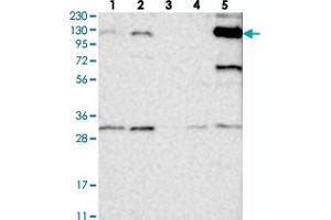 Western blot analysis of Lane 1: RT-4, Lane 2: U-251 MG, Lane 3: Human Plasma, Lane 4: Liver, Lane 5: Tonsil with ANKRD35 polyclonal antibody . (ANKRD35 Antikörper)