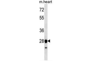 STX8 Antibody (N-term) western blot analysis in mouse heart tissue lysates (35µg/lane). (STX8 Antikörper  (N-Term))