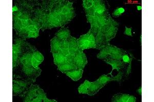 Immunocytochemistry/Immunofluorescence analysis using Mouse Anti-PSD95 Monoclonal Antibody, Clone 6G6 . (DLG4 Antikörper  (APC))