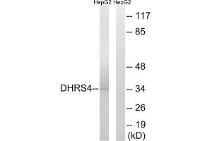 Western blot analysis of extracts from HepG2 cells, using DHRS4 antibody. (DHRS4 Antikörper  (C-Term))