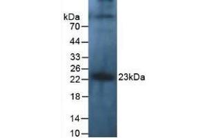 Detection of IL10 in Human Leukocyte Cells using Polyclonal Antibody to Interleukin 10 (IL10) (IL-10 Antikörper  (AA 1-178))