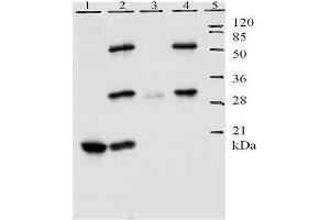 Lane 1 shows detection of E7 protein by Mab 8G6 in lysate of U20S cells. (Human Papilloma Virus 11 E7 (HPV-11 E7) (AA 1-35) Antikörper)