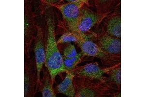 Immunofluorescence (IF) image for anti-Nuclear Factor of kappa Light Polypeptide Gene Enhancer in B-Cells 1 (NFKB1) antibody (ABIN969313)