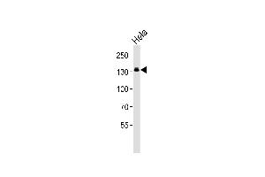 Western blot analysis of lysate from Hela cell line, using GTF2I Antibody at 1:1000. (GTF2I Antikörper  (C-Term))