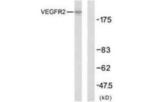 Western Blotting (WB) image for anti-VEGF Receptor 2 (VEGFR2) (AA 917-966) antibody (ABIN2889081) (VEGFR2/CD309 Antikörper  (AA 917-966))
