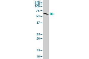 Western Blotting (WB) image for anti-Chromatin Assembly Factor 1, Subunit B (p60) (CHAF1B) (AA 1-559) antibody (ABIN950155)