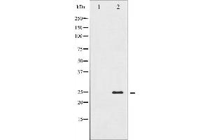 Western blot analysis of TNNI3 expression in Jurkat whole cell lysates,The lane on the left is treated with the antigen-specific peptide. (TNNI3 Antikörper  (N-Term))